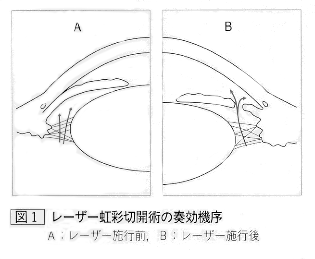 amslerchart